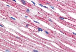 Invitrogen beta Tubulin Monoclonal Antibody (TU-06) 100 &mu;g; Unconjugated:Antibodies,