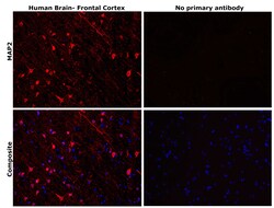 Invitrogen MAP2 Monoclonal Antibody (MT-01) 100 &mu;g | Buy Online | Invitrogen&trade; | Fisher Scientific