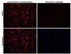 Invitrogen MAP2 Monoclonal Antibody (MT-01) 100 &mu;g | Buy Online | Invitrogen&trade; | Fisher Scientific