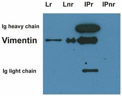 Invitrogen Vimentin Monoclonal Antibody (VI-01) 100 &mu;g; Unconjugated:Antibodies,