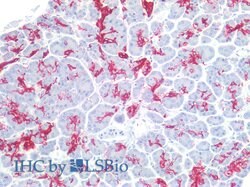 Invitrogen CA19-9 Monoclonal Antibody (121SLE) 100 &mu;g; Unconjugated:Antibodies,