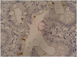 Invitrogen CA19-9 Monoclonal Antibody (121SLE) 100 &mu;g; Unconjugated:Antibodies,