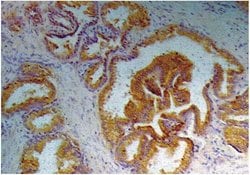 Invitrogen PSA Monoclonal Antibody (A67-B/E3) 100 &mu;g; Unconjugated:Antibodies,