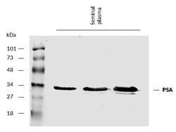 Invitrogen PSA Monoclonal Antibody (A67-B/E3) 100 &mu;g; Unconjugated:Antibodies,