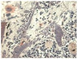 Invitrogen HLA-G Monoclonal Antibody (MEM-G/1) 100 &mu;g; Unconjugated:Antibodies,