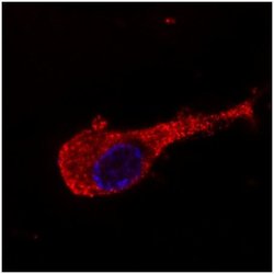 Invitrogen NEFM Monoclonal Antibody (NF-09) 100 &mu;g; Unconjugated:Antibodies,