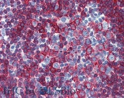 Invitrogen HLA-DR/DP Monoclonal Antibody (MEM-136) 100 &mu;g; Unconjugated:Antibodies,