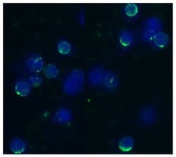 Invitrogen CD62L Monoclonal Antibody (IVA94) 100 μg; Unconjugated:Antibodies,