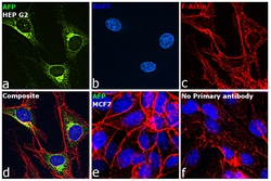 Invitrogen AFP Monoclonal Antibody (AFP-11) 100 &mu;g; Unconjugated:Antibodies,