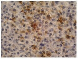 Invitrogen AFP Monoclonal Antibody (AFP-11) 100 &mu;g; Unconjugated:Antibodies,