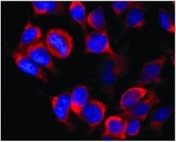 Invitrogen Kinesin 5B Monoclonal Antibody (KN-02) 100 &mu;g; Unconjugated:Antibodies,