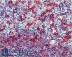 Invitrogen HLA-E Monoclonal Antibody (MEM-E/06) 100 &mu;g; Unconjugated:Antibodies,