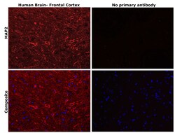 Invitrogen MAP2 Monoclonal Antibody (MT-07) 100 &mu;g; Unconjugated:Antibodies,