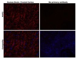 Invitrogen MAP2 Monoclonal Antibody (MT-08) 100 &mu;g; Unconjugated:Antibodies,