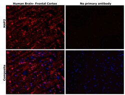 Invitrogen MAP2 Monoclonal Antibody (MT-08) 100 &mu;g; Unconjugated:Antibodies,