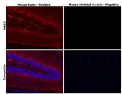 Invitrogen MAP2 Monoclonal Antibody (MT-08) 100 &mu;g; Unconjugated:Antibodies,