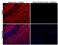 Invitrogen MAP2 Monoclonal Antibody (MT-08) 100 &mu;g; Unconjugated:Antibodies,