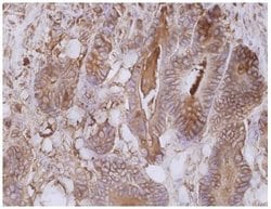 Invitrogen CEA Monoclonal Antibody (CB30) 100 &mu;g; Unconjugated:Antibodies,