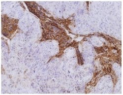 Invitrogen CEA Monoclonal Antibody (CB30) 100 &mu;g; Unconjugated:Antibodies,
