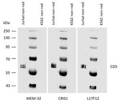 Invitrogen CD5 Monoclonal Antibody (CRIS1) 100 &mu;g; Unconjugated:Antibodies,
