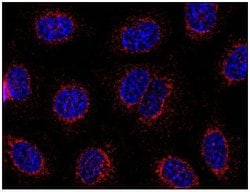 Invitrogen STIM1 Monoclonal Antibody (CDN3H4) 100 &mu;g | Buy Online | Invitrogen&trade; | Fisher Scientific