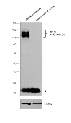 Invitrogen NF-H Monoclonal Antibody (3G3) 100 &mu;g | Buy Online | Invitrogen&trade; | Fisher Scientific
