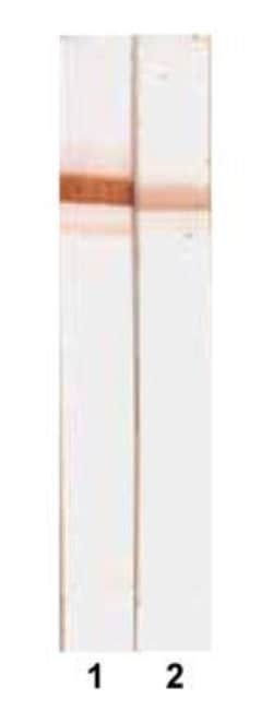 Invitrogen Human Serum Albumin Monoclonal Antibody (6B11) 100 &mu;g; Unconjugated:Antibodies,