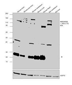 Invitrogen NMDAR2B Monoclonal Antibody (NR2B) 100 &mu;g; Unconjugated:Antibodies,