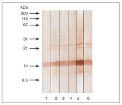 Invitrogen Calcitonin Monoclonal Antibody (13B9) 100 μg; Unconjugated:Antibodies,