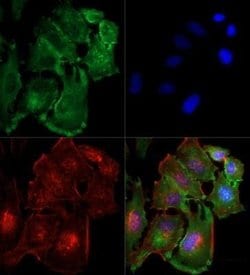 Invitrogen TBK1 Monoclonal Antibody (108A429) 50 &mu;g; Unconjugated:Antibodies,