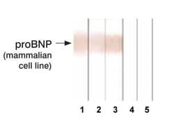 Invitrogen pro-Brain Natriuretic Peptide Monoclonal Antibody (5B6) 200