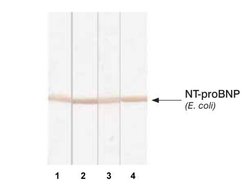 Invitrogen pro-Brain Natriuretic Peptide Monoclonal Antibody (15F11) 200
