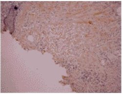 Invitrogen Osteocalcin Monoclonal Antibody (OC4-30) 50 &mu;g | Buy Online | Invitrogen&trade; | Fisher Scientific