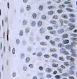 Invitrogen CENPA Monoclonal Antibody (3-19) 50 &mu;g; Unconjugated:Antibodies,