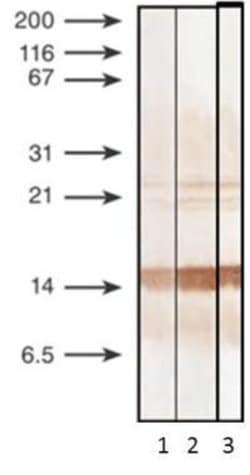 Invitrogen Procalcitonin Monoclonal Antibody (44d9) 100 &mu;g; Unconjugated:Antibodies,