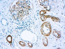 Invitrogen Laminin alpha-1 Monoclonal Antibody (4C7) 500 &mu;L; Unconjugated:Antibodies,