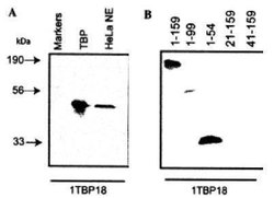 Invitrogen TBP Monoclonal Antibody (1TBP18) 100 &mu;g; Unconjugated:Antibodies,