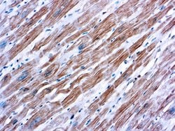 Invitrogen Sarcomeric alpha Actinin Monoclonal Antibody (EA-53) 500 &mu;L;