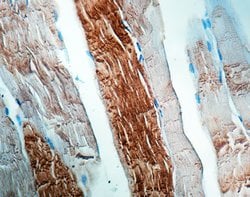 Invitrogen Sarcomeric alpha Actinin Monoclonal Antibody (EA-53) 500 &mu;L;