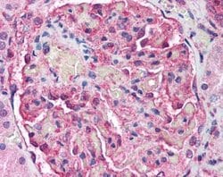 Invitrogen ATM Monoclonal Antibody (2C1) 100 &mu;L; Unconjugated:Antibodies,