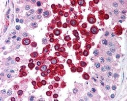 Invitrogen ATM Monoclonal Antibody (2C1) 100 &mu;L; Unconjugated:Antibodies,