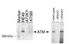 Invitrogen ATM Monoclonal Antibody (2C1) 100 &mu;L; Unconjugated:Antibodies,