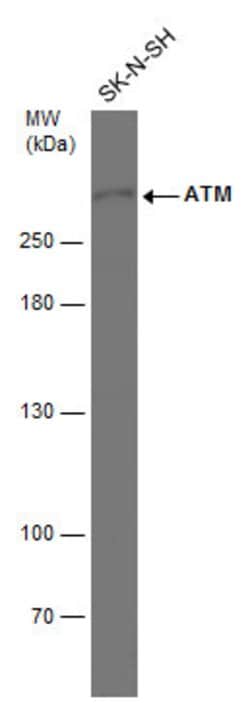 Invitrogen ATM Monoclonal Antibody (2C1) 100 &mu;L; Unconjugated:Antibodies,