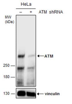 Invitrogen ATM Monoclonal Antibody (2C1) 100 &mu;L; Unconjugated:Antibodies,