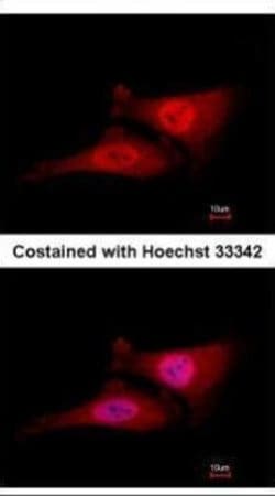 Invitrogen Cdc34 Monoclonal Antibody (14B5) 100 &mu;L; Unconjugated:Antibodies,