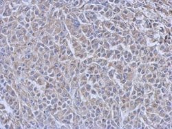 Invitrogen Cdc34 Monoclonal Antibody (14B5) 100 &mu;L; Unconjugated:Antibodies,