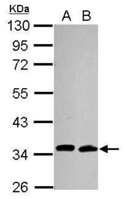 Invitrogen Cdc34 Monoclonal Antibody (14B5) 100 &mu;L; Unconjugated:Antibodies,