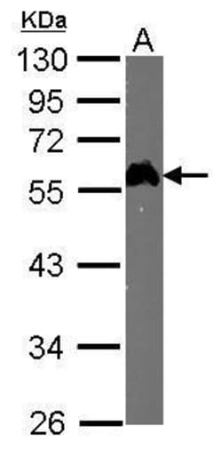 Invitrogen E2F1 Monoclonal Antibody (17E2) 100 &mu;L | Buy Online | Invitrogen&trade; | Fisher Scientific