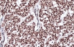 Invitrogen Estrogen Receptor beta Monoclonal Antibody (14C8) 100 &mu;L;