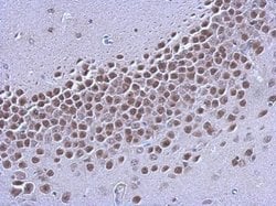 Invitrogen Estrogen Receptor beta Monoclonal Antibody (4D2) 100 &mu;L;